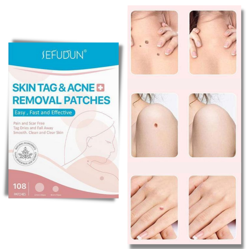 Skin tag removal treatment patch